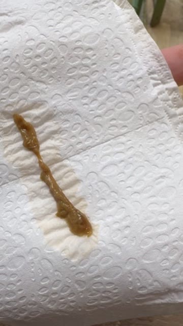 Registro visual 1 enviado pela comunidade após uma prática de limpeza
